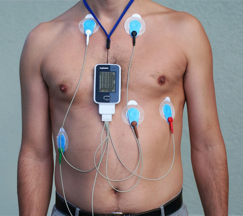 Monitorizare Holter ECG Alba Iulia