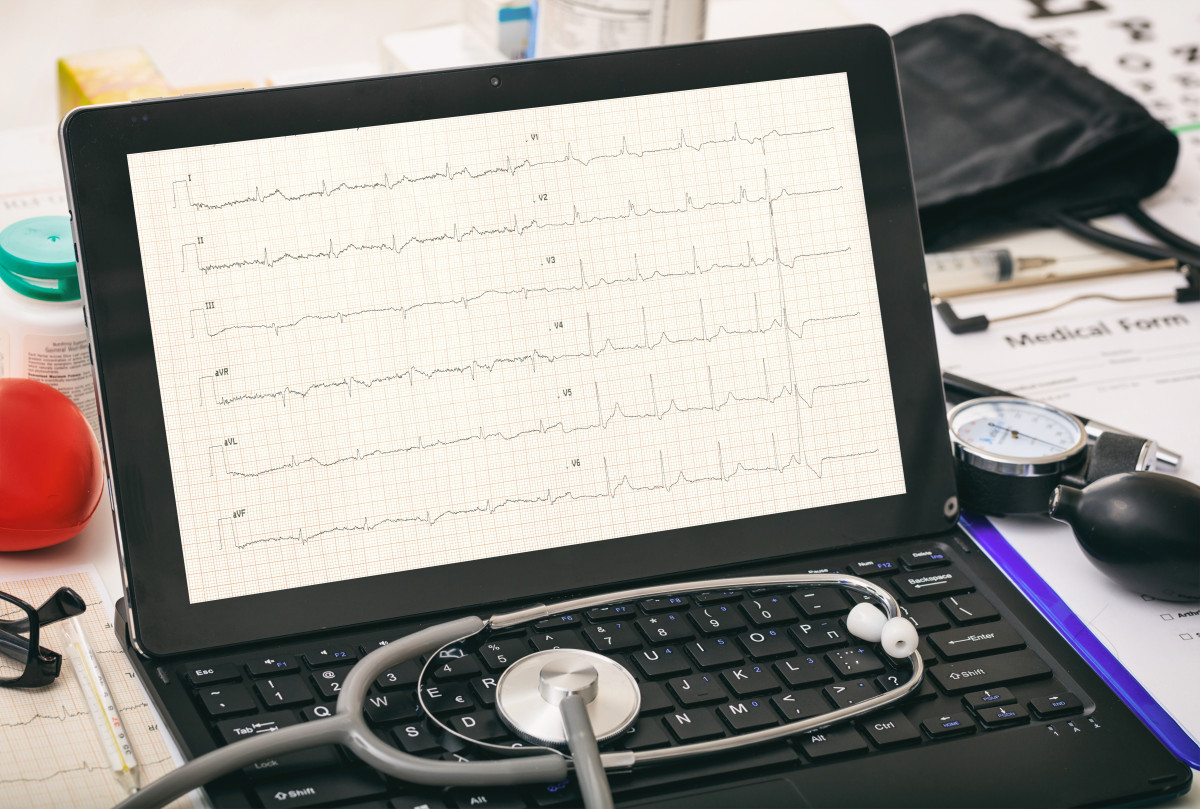 EKG electrocardiograma Alba Iulia